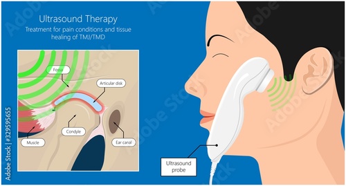Temporomandibular Joint Disorders TMD TMJ treat pain displaced disc temporal bone locking bite plate plastic guard night Transcutaneous electrical nerve stimulation TENS Arthroscopy occlusal oral