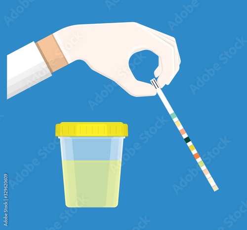 Urine tract exam doctor clinic kidney sick tool pee piss chart color test lab strip pH bottle digital result device medical machine screen science sample measure chronic ketone Diabetes annual