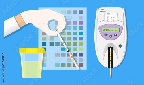 Urine tract exam doctor clinic kidney sick tool pee piss chart color test lab strip pH bottle digital result device medical machine screen science sample measure chronic ketone Diabetes annual