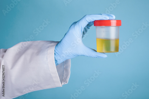 doctor in a white medical gown and blue gloves on a blue background holds in his hand a jar for medical tests with a red lid with yellow urine