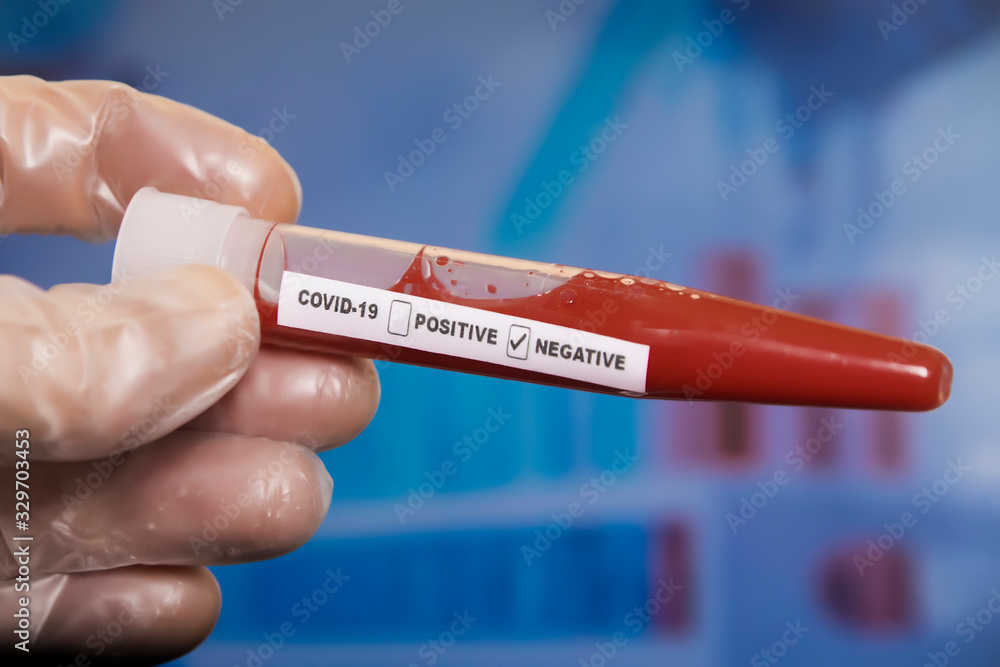 Fototapeta premium Tubo de muestra con sangre negativE con COVID-19 o nuevo coronavirus