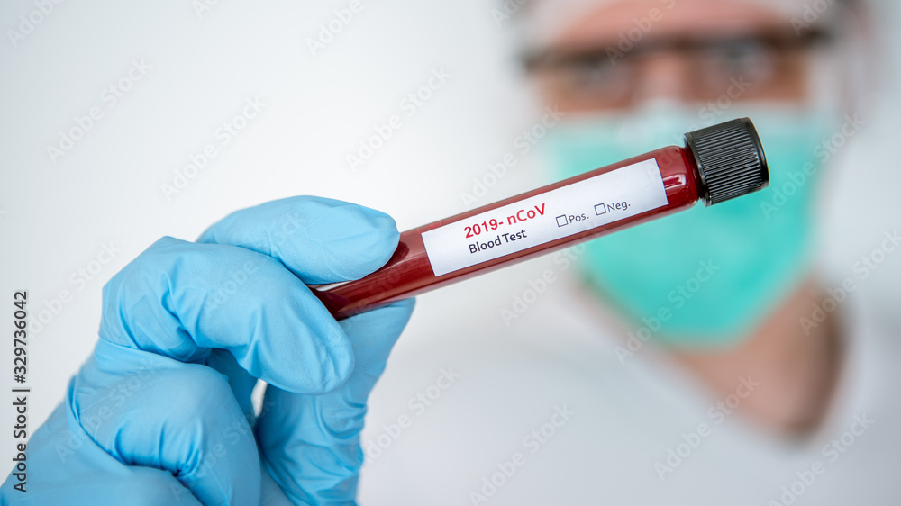 Obraz premium Scientist with coronavirus Covid 19 infected blood sample tube. Pandemic concept