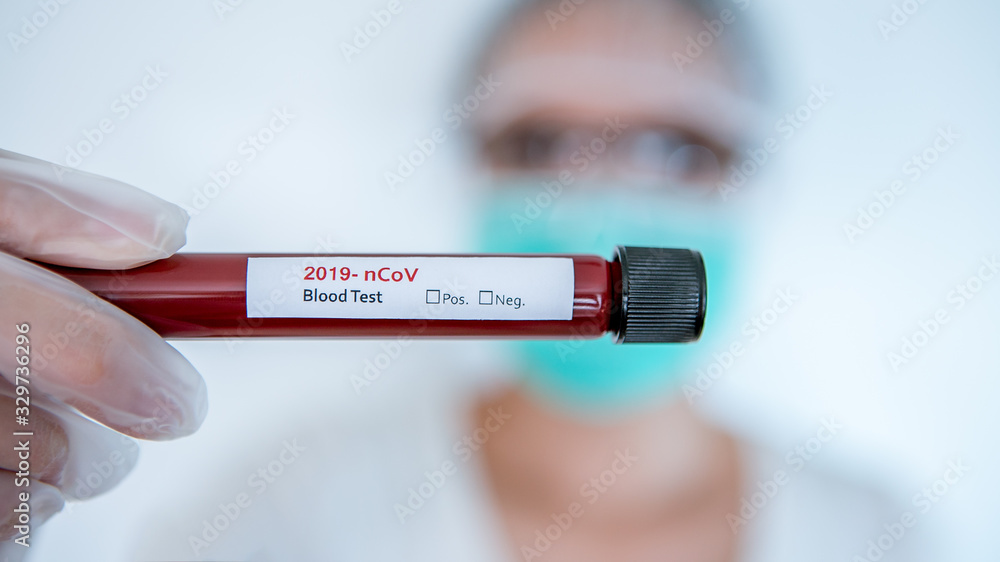 Obraz premium Asian woman COVID-19 laboratory test sample of blood new Corona virus infection