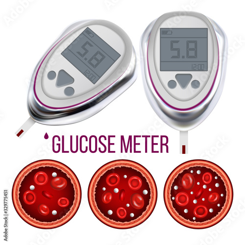 Glucose Meter And Sugar Level In Blood Vector. Hypoglycemia, Normal Glucose Level And Hyperglycemia, Aorta Or Vein Artery. Medical Electronic Equipment And Diagram Template Realistic 3d Illustration