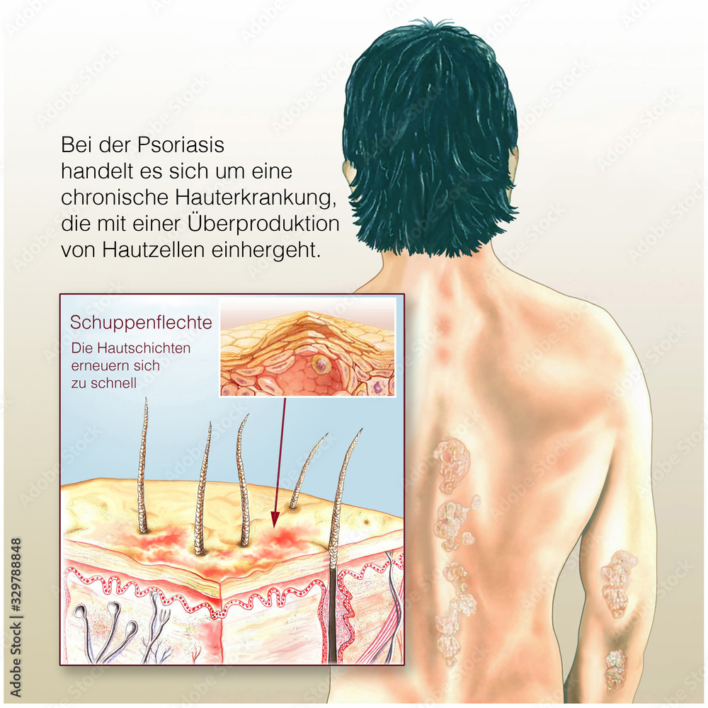 Hautoberfläche Images – Browse 59 Stock Photos, Vectors, and Video | Adobe  Stock, image size:1000x1000