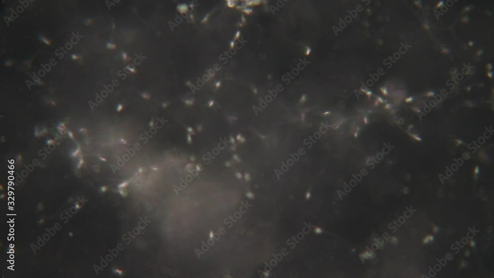 Semen, seminal fluid of Human under the microscope. Semen, seminal fluid of Human under the microscope.