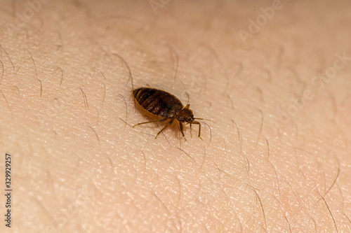 Bed Bug Up Close 