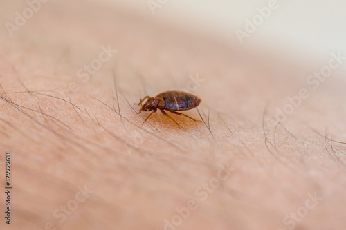 Foto Bed Bug On Skin