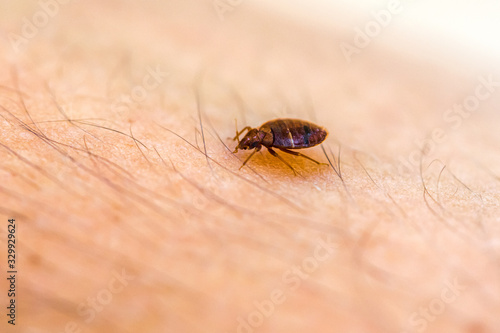 Bed Bug On Skin 