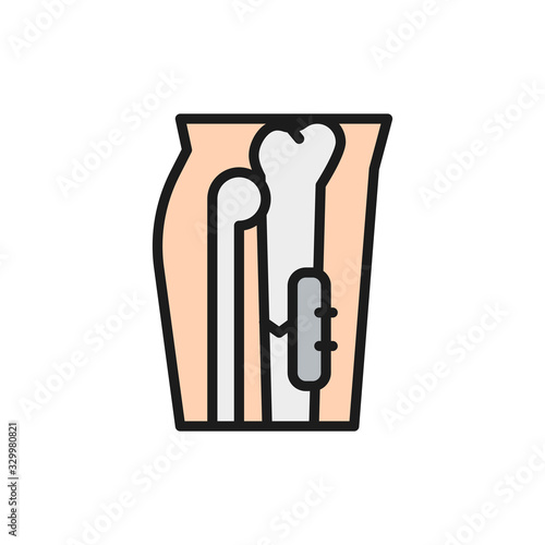 X-ray of broken leg, bone fixed with medical implantable plate flat color icon.