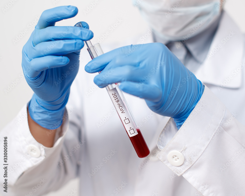 the epidemiologist takes blood tests for coronavirus. the epidemiologist takes blood tests for coronavirus.