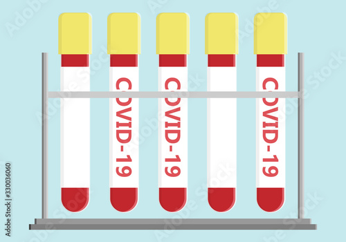 Probetas con muestras de Sangre y Covid-19