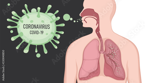 Human symptoms of coronavirus, tuberculosis, pneumonia, colds. A person infected with a coronavirus. CoVID-19 Virus outbreak spread.