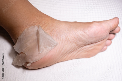 Women skin foot peeling left foot, on white background