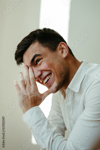 Junger Mann mit Pigmentstörung, Vitiligo im Lifestyle Portrait 