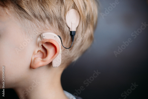 cochlear implant on the boy’s head. hearing aid. copy space photo