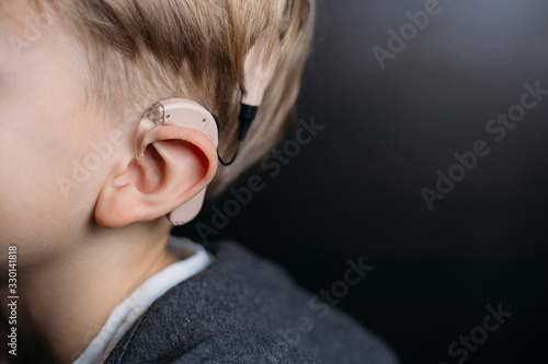 cochlear implant on the boy’s head. hearing aid. copy space photo