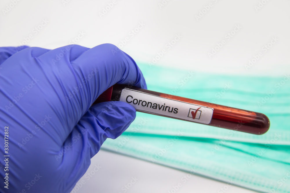 Obraz premium Coronavirus blood test 2019.Coronavirus came from Wuhan, China. Doctor hand in medical glove holding test tube with Coronavirus positive blood in laboratory. Concept can be used in the design