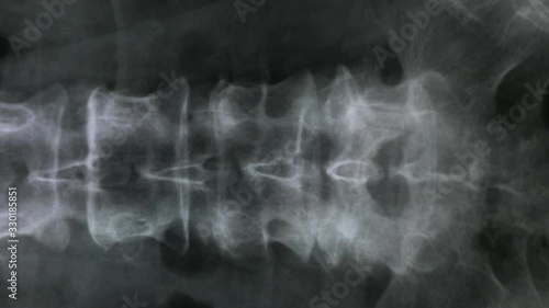 X-ray of the bones of the human vertebral column and pelvis, 4K