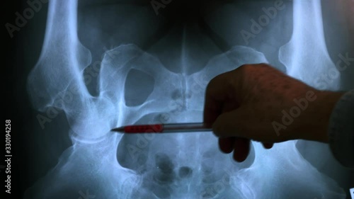 Doctor studying X-ray of pelvic bones , 4K