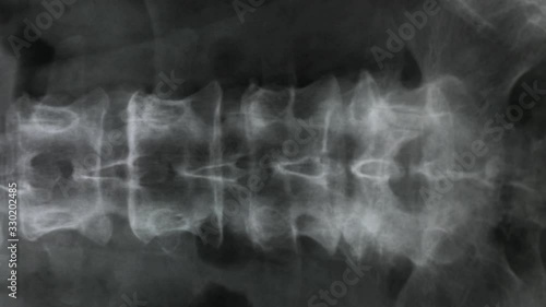 X-ray of the bones of the human vertebral column and pelvis, 4K