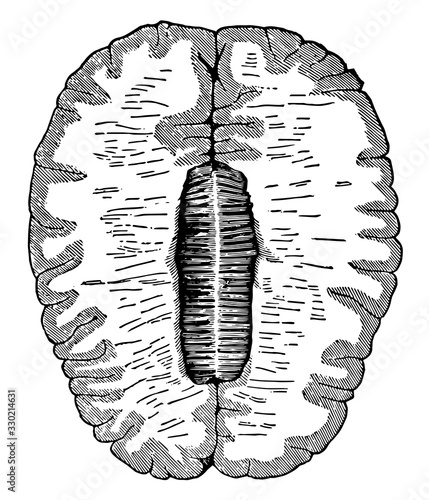 Cross-Section of the Brain, vintage illustration