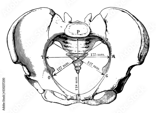 Pelvic Inlet, vintage illustration.