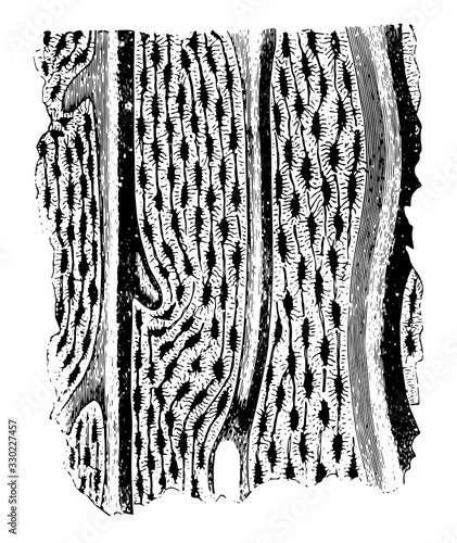 Human Ulna, vintage illustration