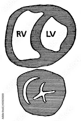 Transverse Section through the Ventricle of a Dog's Heart, vintage illustration