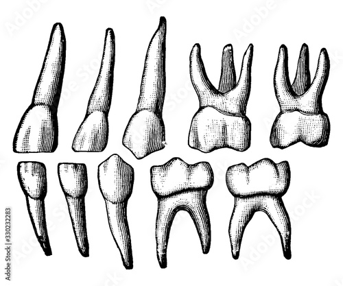 Temporary Teeth, vintage illustration.