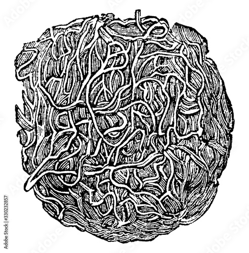 Blood Clotting Fibers, vintage illustration.
