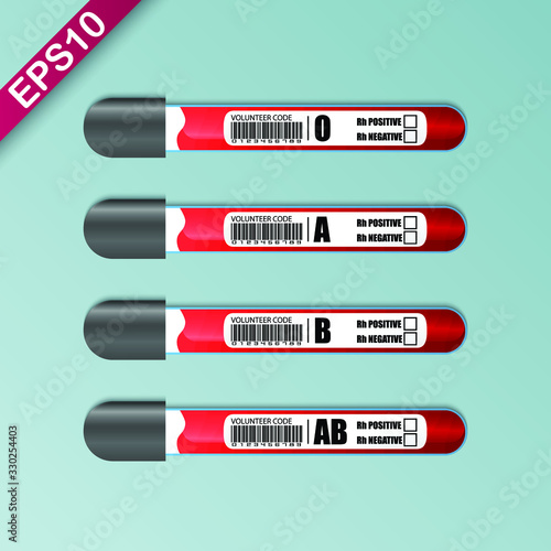 Blood Types in EDTA tube. Human blood is grouped into four types A, B, AB, and O.