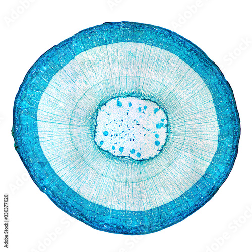 Stem of wood dicotyledon, whole cross section under microscope. Light microscope slide with the microsection of a wood stem with vascular bundles, concentric arranged in a ring. Plant anatomy. Photo.