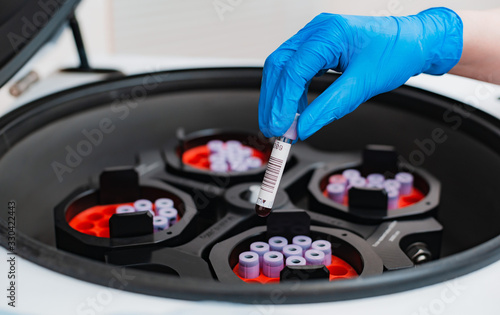 A test tube with blood tests is placed in a centrifuge with a hand in a blue rubber glove