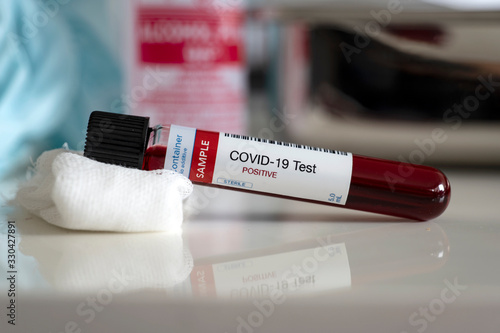 Coronavirus positive blood test sample in laboratory photo