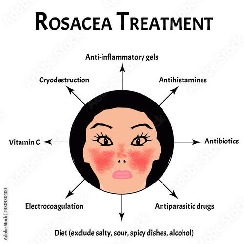 Rosacea treatment. Rosacea Awareness Month. Infographics. Vector illustration on isolated background.