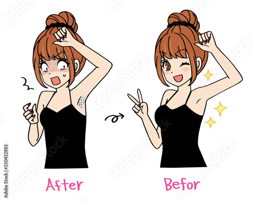 脱毛　ビフォーアフター