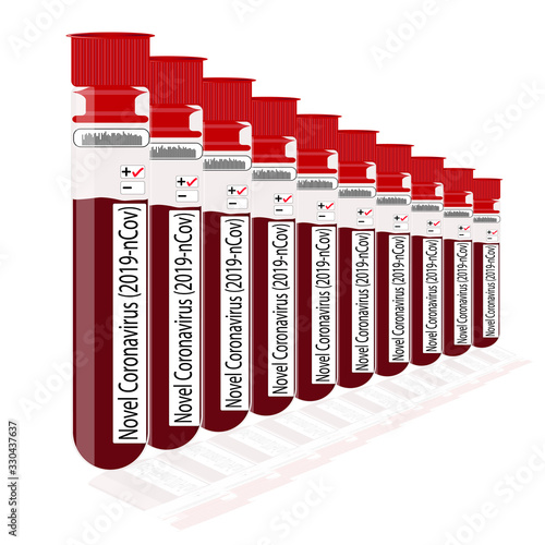 Microbiological blood sample many others test tubes exam analysis hospital results show positive for Novel Coronavirus (2019-nCoV) vector illustration