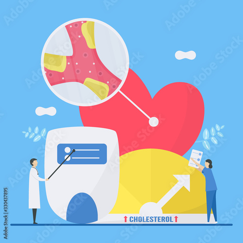 Cardiology vector illustration. Atherosclerosis is disease that plaque builds up inside arteries. Blood vessel is narrow and hard because high level of fat and cholesterol.