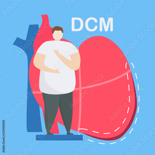 Cardiology vector illustration. This disease calls Dilated Cardiomyopathy. Ability of blood pumping is decreased. Left ventricle room of heart is enlarged and weakened. Flat tiny element EPS10.