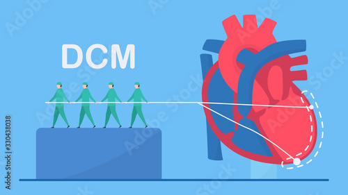 Cardiology vector illustration. This disease calls Dilated Cardiomyopathy. Ability of blood pumping is decreased. Left ventricle room of heart is enlarged and weakened. Flat tiny element EPS10.