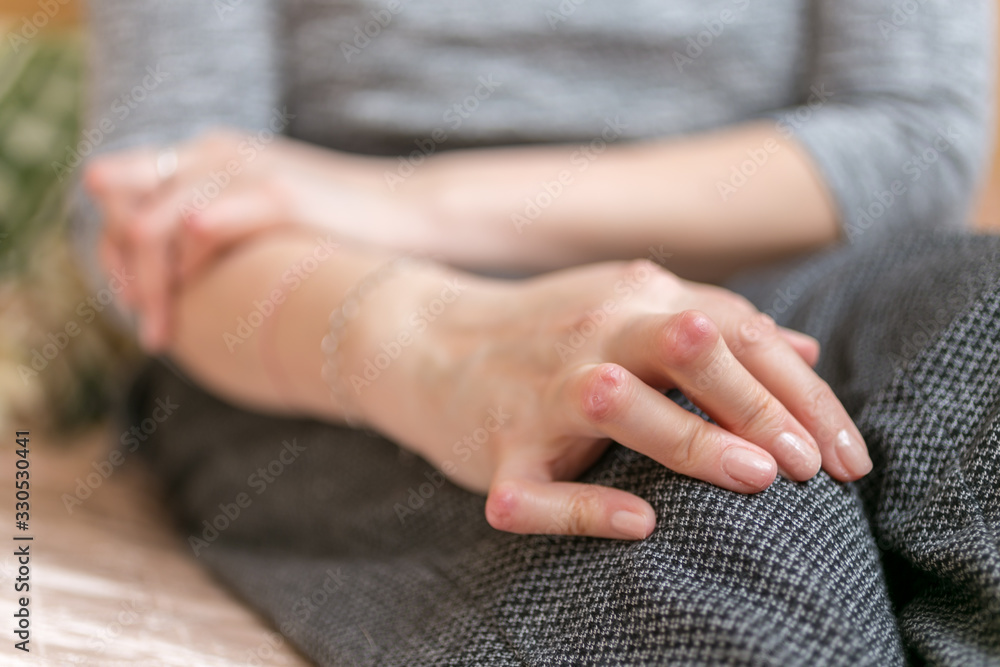 Young woman having rheumatoid arthritis takes a rest sittinng on the couch. Hands and legs are deformed. She feels pain. Selected focus.