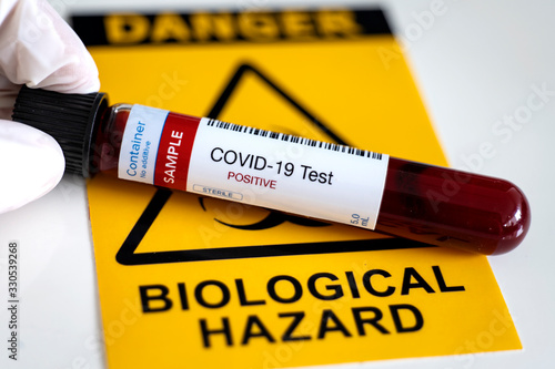 Testing for presence of coronavirus. Tube containing a blood sample that has tested positive for COVID-19. photo