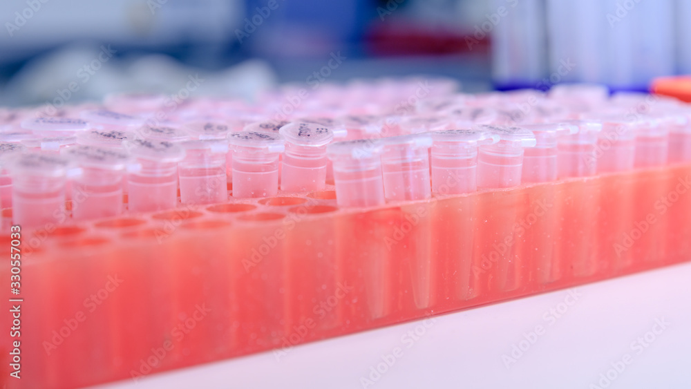 Laboratory rack with plastic tubes for DNA study. DNA gel-loading. Concept of science, laboratory and study of diseases. Laboratory rack with plastic tubes for DNA study. DNA gel-loading. Concept of science, laboratory and study of diseases.