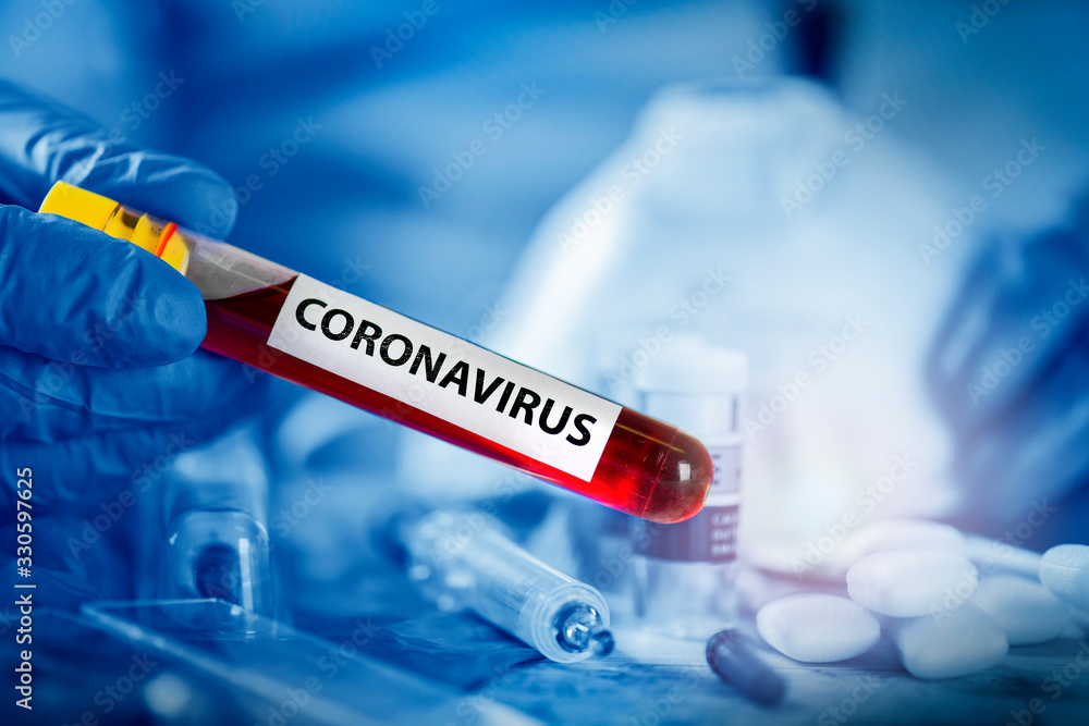 Obraz premium Coronavirus blood sample in blue glove hand with positive blood dangrous virus