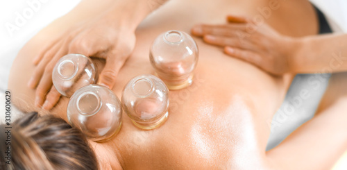 Detail of a woman therapist hands giving cupping treatment on back. photo