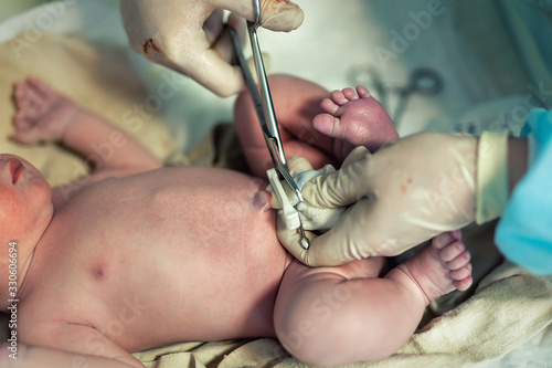 Close-up doctor obstetrician nurse cutting umbilical cord with medical scissors to newborn infant baby. Medical surgeon giving birth to child. New human life begin. delivery labor childbirth hospital photo