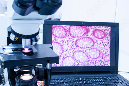 Fotografía Modern microscope and human tissue section slide with computer monitor show glandular image