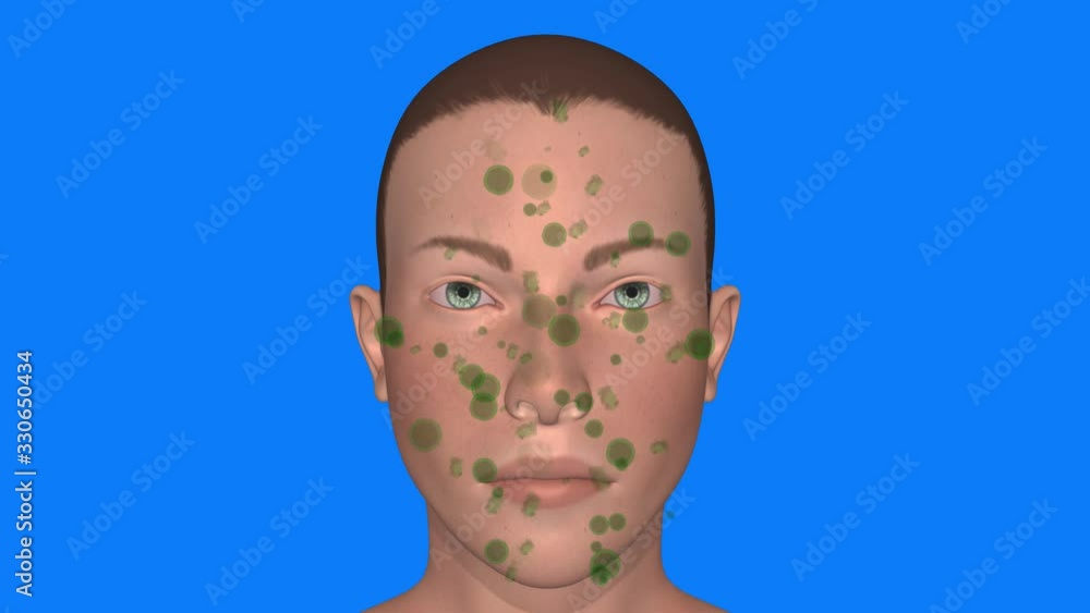 Human face covered with dirt , germs , bacteria , viruses. 3d animation Human face covered with dirt , germs , bacteria , viruses. 3d animation