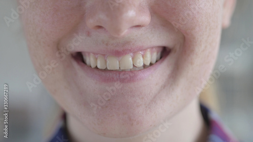 The Close Up of Young Woman's Smile